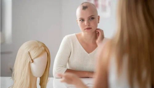 Femme atteinte d’alopécie essayant une perruque blonde Femme souffrant d’alopécie observant une perruque blonde lors d’un accompagnement en relooking